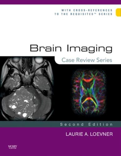 Cover of Brain imaging by Laurie A. Loevner