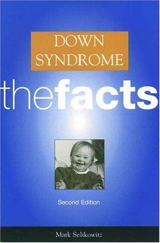 Cover of Down syndrome by Mark Selikowitz