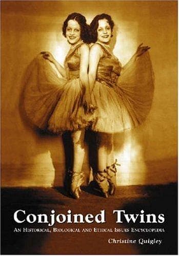 Cover of Conjoined Twins by Christine Quigley