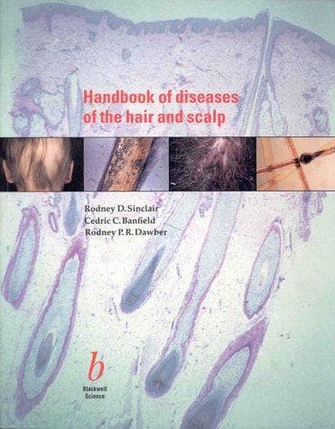Cover of Handbook of diseases of the hair and scalp by Rodney D. Sinclair