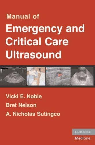 Cover of Manual of emergency ultrasound by Vicki E. Noble