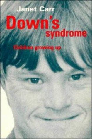 Cover of Down's syndrome by Janet H. Carr