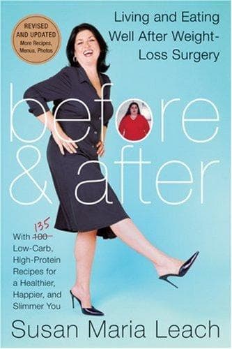 Cover of Before & After by Susan Maria Leach