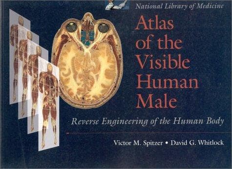 Cover of Atlas of the visible human male by Victor M. Spitzer