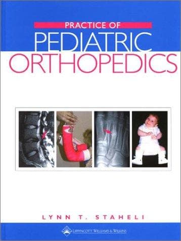 Cover of Practice of Pediatric Orthopedics by Lynn T. Staheli