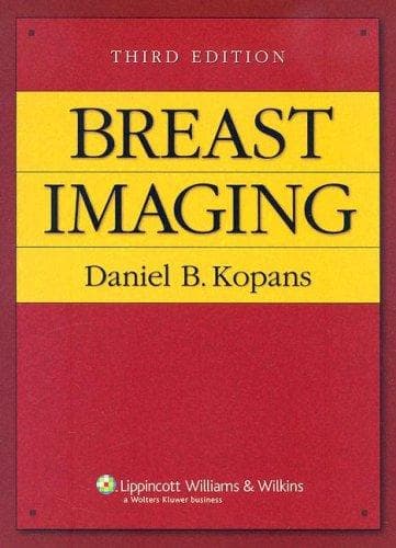 Cover of Breast imaging by Daniel B. Kopans