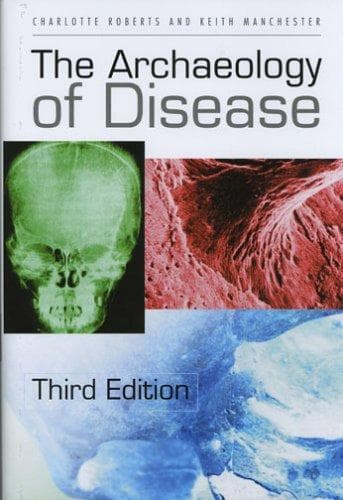 Cover of The archaeology of disease by Charlotte A. Roberts