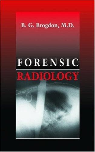 Cover of Forensic radiology by B. G. Brogdon