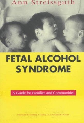 Cover of Fetal alcohol syndrome by Ann Pytkowicz Streissguth