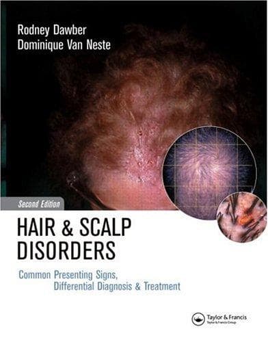 Cover of Hair and scalp disorders by R. P. R. Dawber