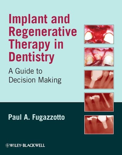 Cover of Implant and regenerative therapy by Paul A. Fugazzotto