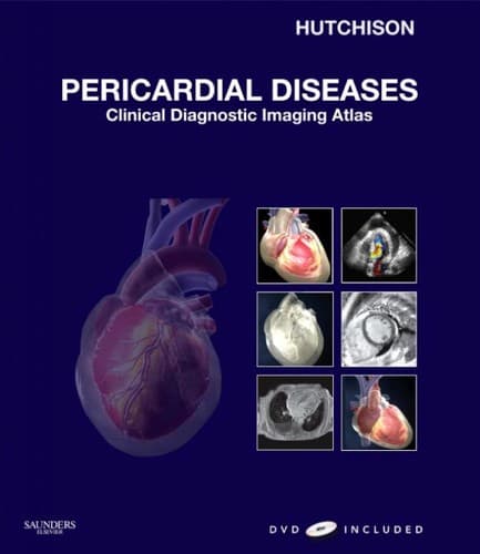 Cover of Pericardial diseases by Natalii︠a︡ Vladimirovna Baklanova