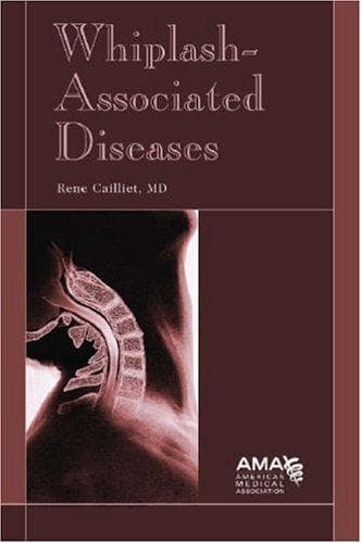 Cover of Whiplash-associated diseases by Rene Cailliet