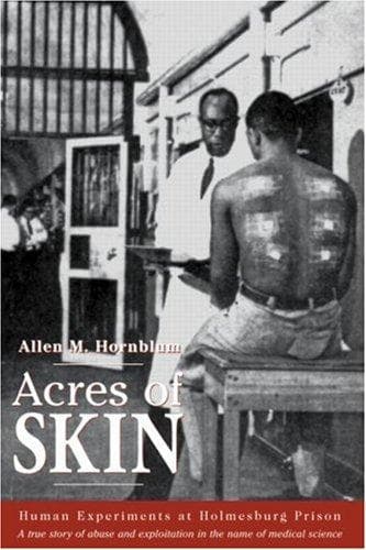 Cover of Acres of skin by Allen M. Hornblum